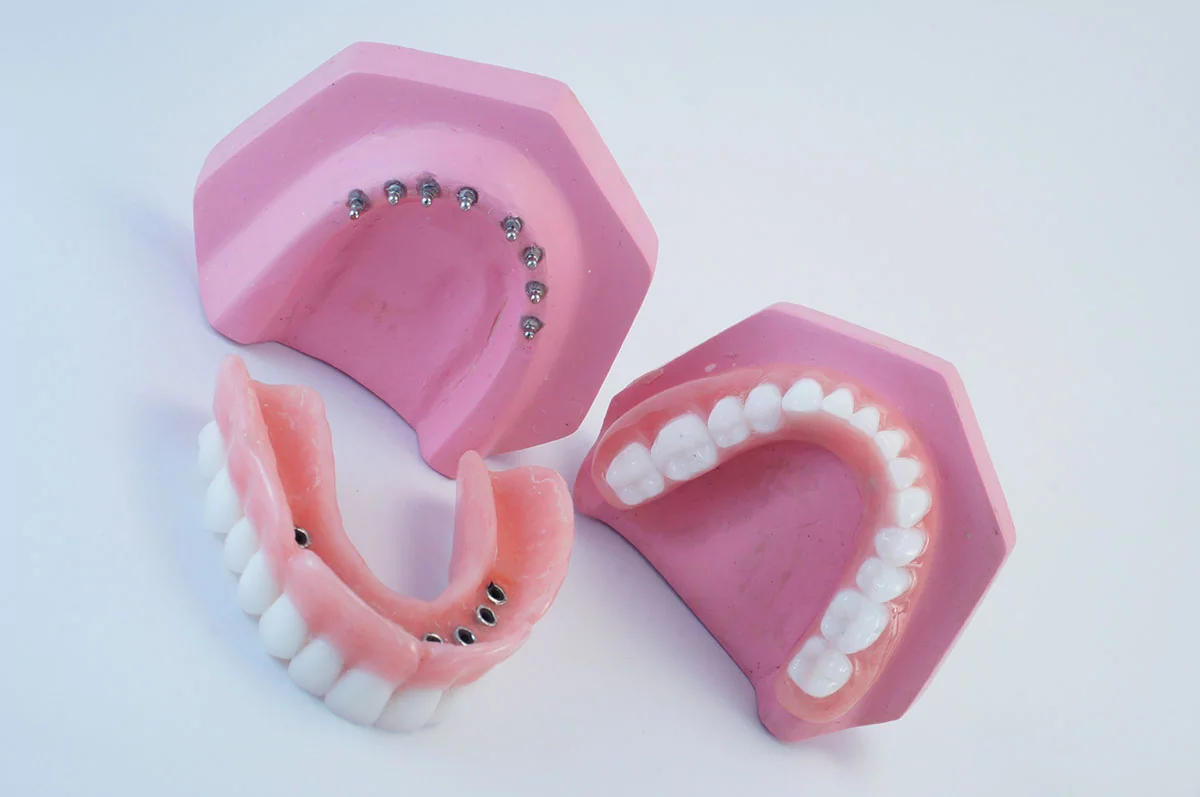snap-in-dentures (2)