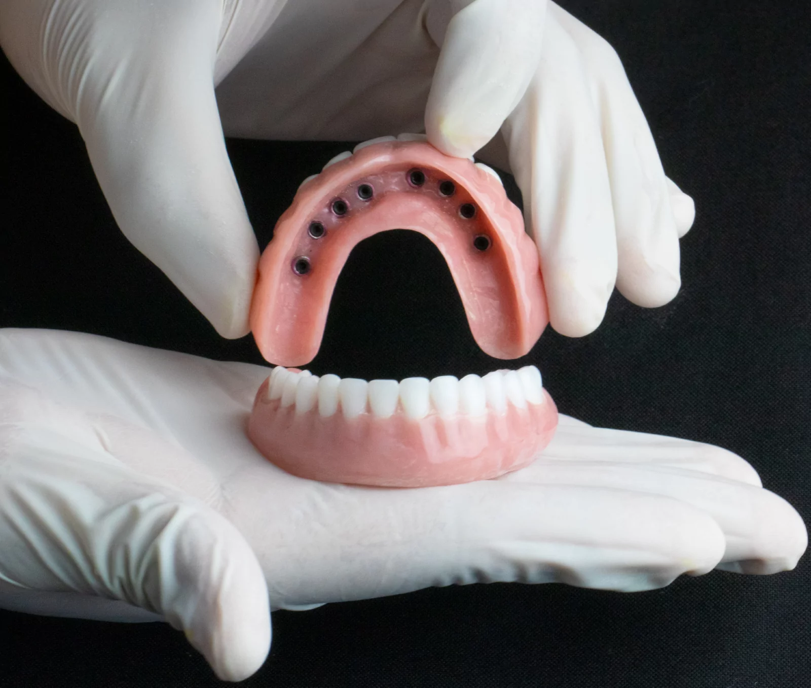 snap-in-dentures (23)