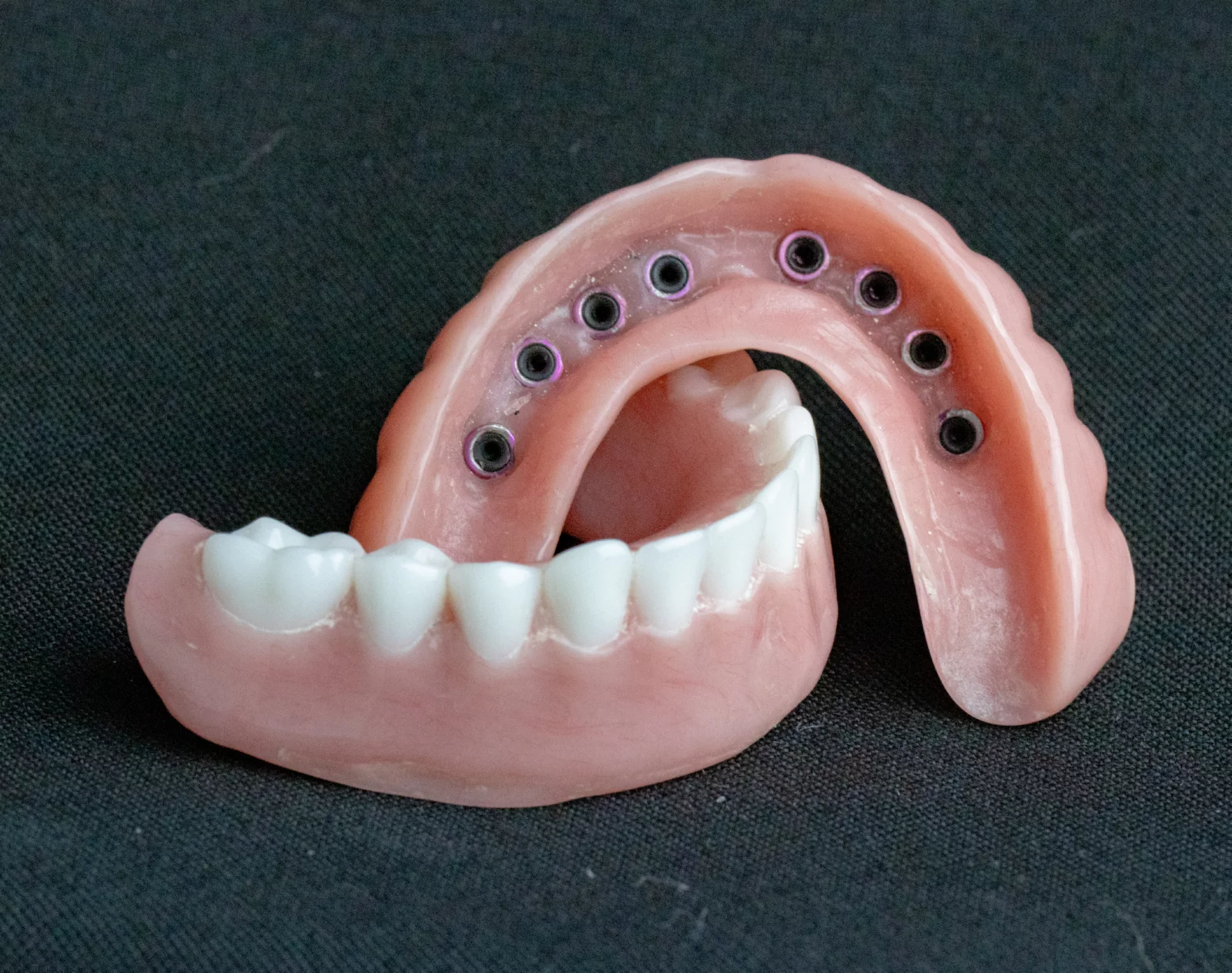 snap-in-dentures (27)