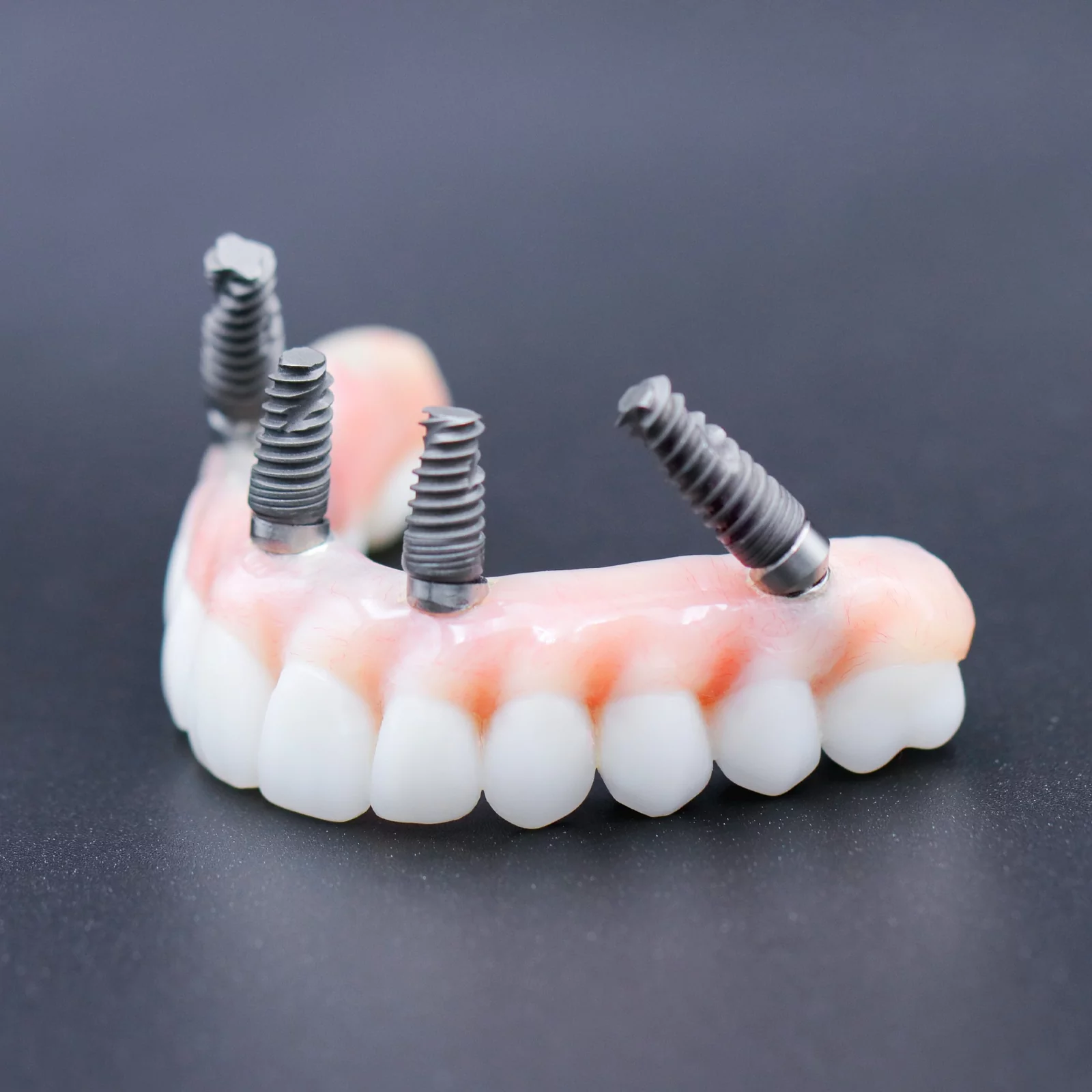 all-on-4-treatment-5