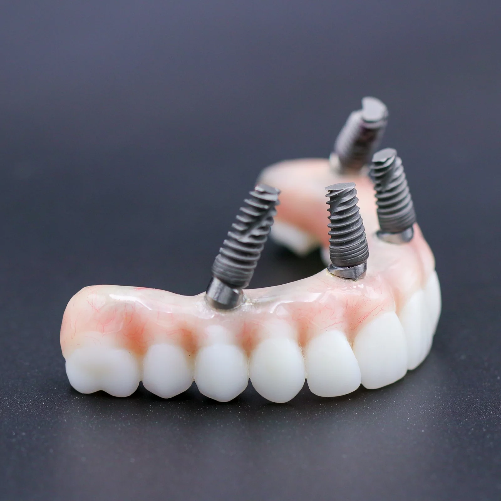 all-on-4-treatment-7